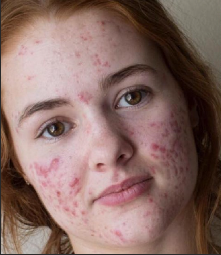 Before using KS-Rejuvenate Toner Pads